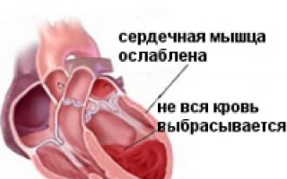 Причини та симптоми серцевої недостатності Хронічна серцева недостатність