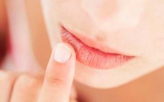Як вилікувати обвітрені губи швидко в домашніх умовах?